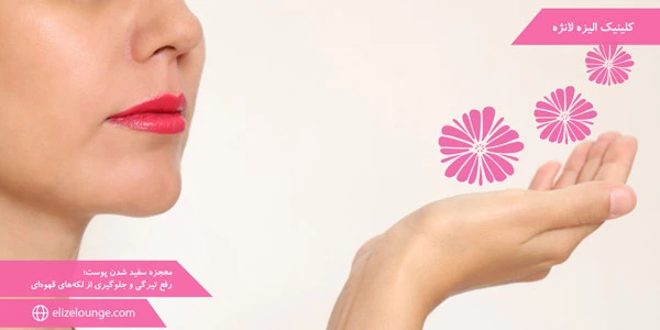 The-miracle-of-skin-whitening;-Removing-darkness-and-preventing-brown-spots
