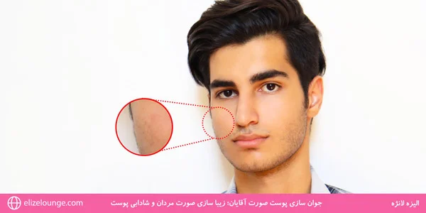 facial-skin-rejuvenation-for-men-Mens-face-beautification-and-skin-freshness