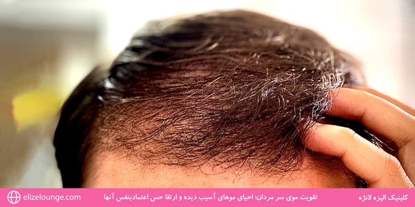 Strengthening-mens-hair-Reviving-damaged-hair-and-improving-their-confidence