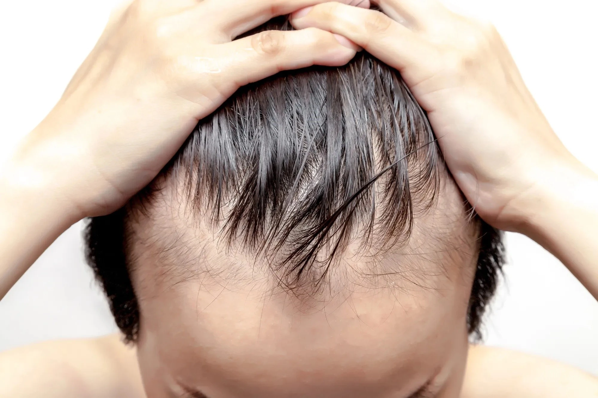 Causes-hair-loss-boys