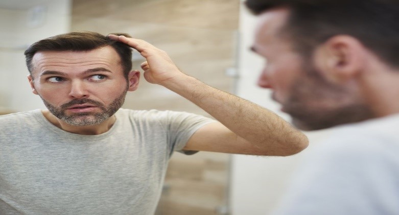 لیستی جامع از مهم‌ترین و شایع‌ترین علت ریزش مو شقیقه در مردان