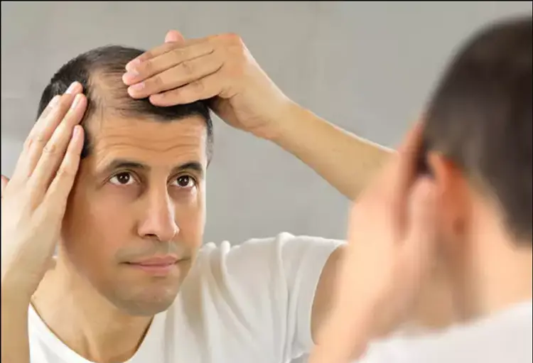 Strengthening-men-s-hair-follicles