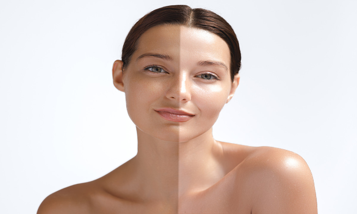 چگونه پوستی سفید داشته باشیم